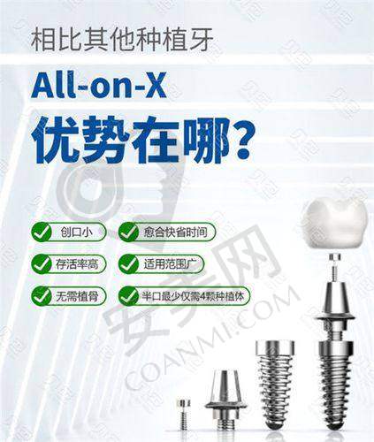 选择徐州中牙口腔何翀 all - on - 4 半口种植牙有哪些保护？