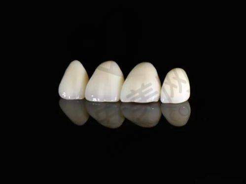 全瓷牙冠修复的具体过程是怎样的？