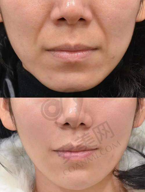 顾客实例分享：见证真实成效