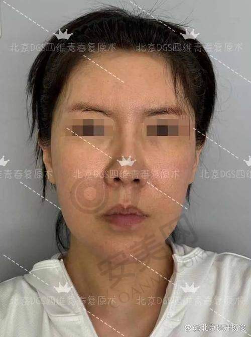 就诊前需要做哪些准备？
