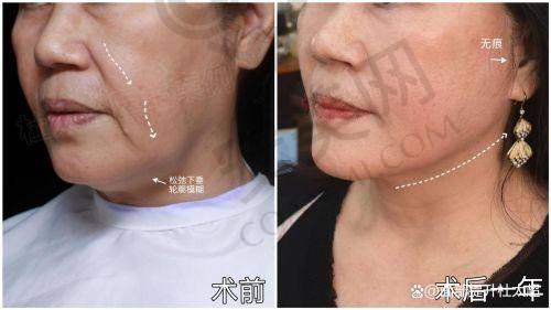 与医生沟通，制定方案
