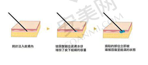 深圳鹏程医院的口碑评价