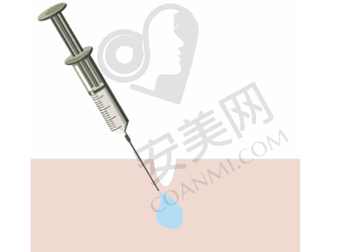 内外轮廓微整注射能带来哪些成效？