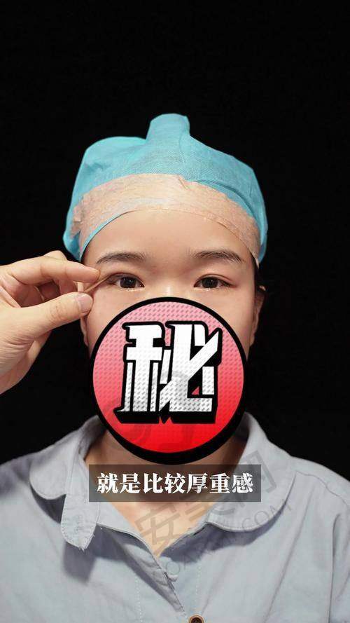 手术的安心性如何保护？
