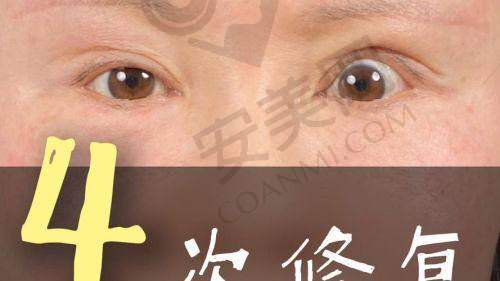 三、各位骨干医生及所在医院详细攻略