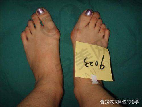 患者口碑：真实反馈见分晓
