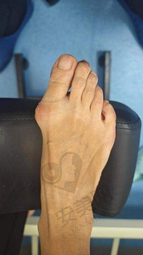 总结