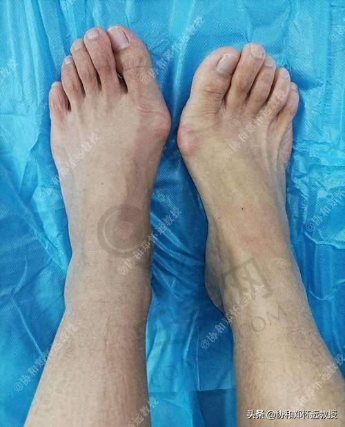 手术过程是怎样的体验？
