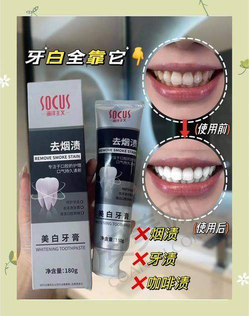 张家界博瑞口腔牙齿贴面美白为何只需1200元起？