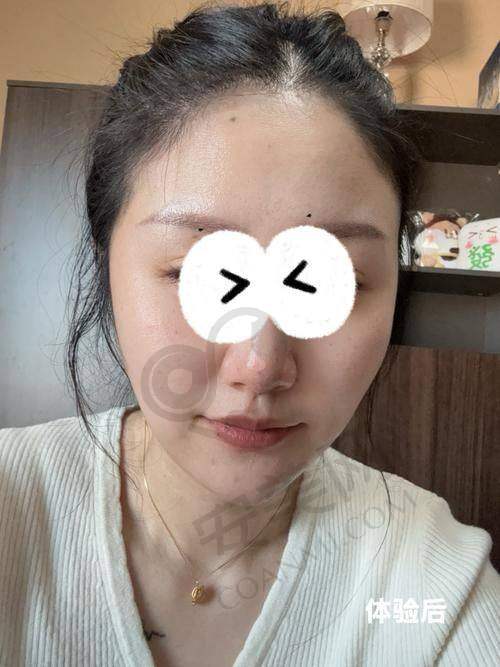 深圳艺星：专精医美品牌的魅力