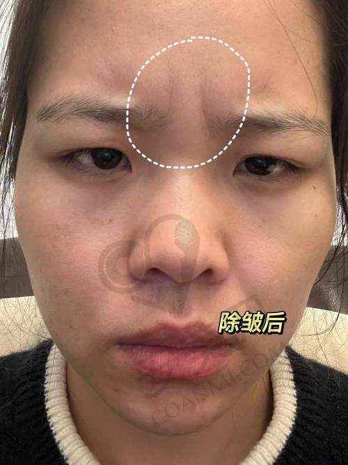 成效展现：焕颜之旅的惊喜
