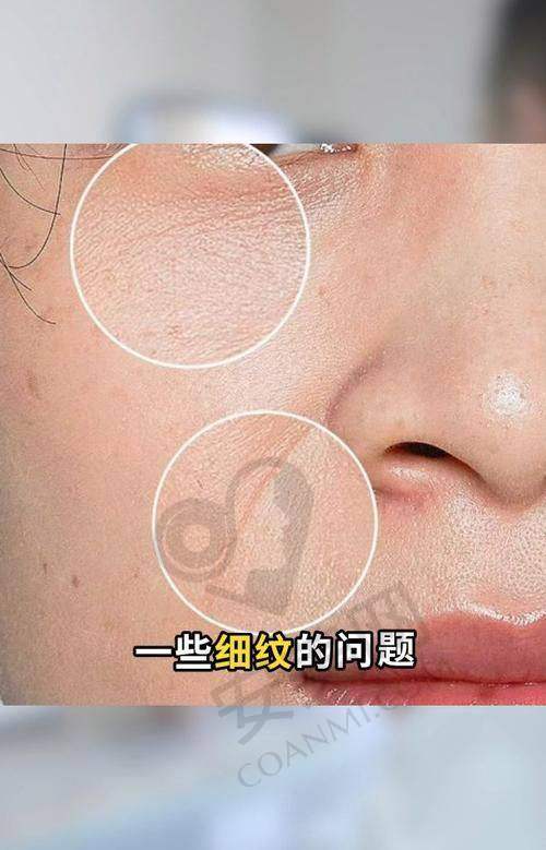 选择深圳艺星蒲翠玲医生的理由
