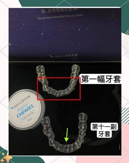 时代天使隐形矫正：优势尽显