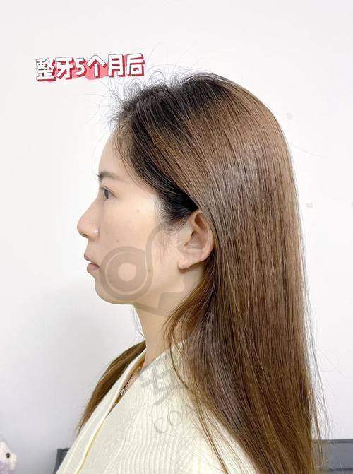 总结