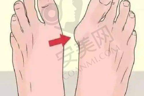 术后修复情况如何？