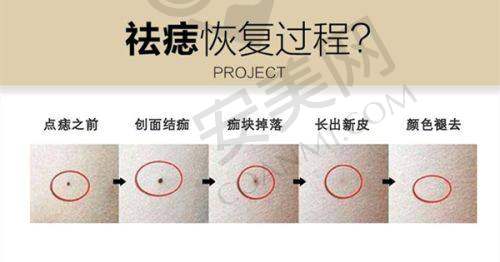 蔡圣民院长亲诊，专精保护美肤成效
