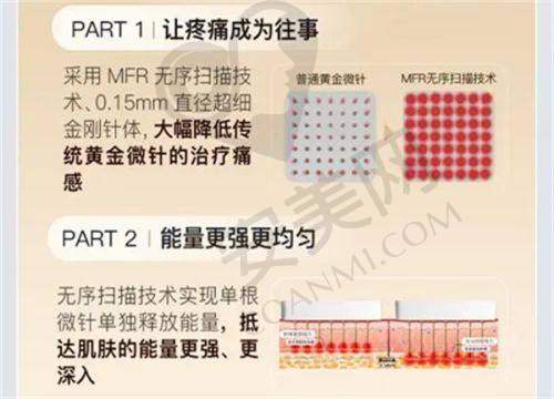 吴健医生在半岛黄金微针4.0治疗中有何优势？