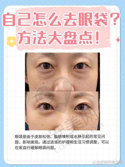 外地患者专属补贴，绿色通道效率高省心