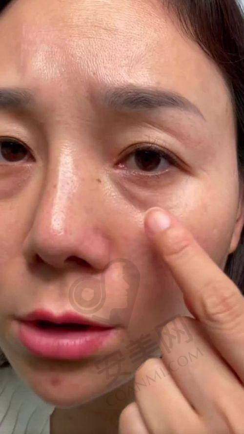 真实口碑与三重保护，让变得更美更安心