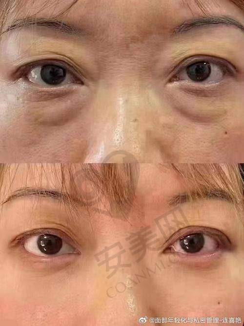 线上预约流程，简单便捷轻松搞定