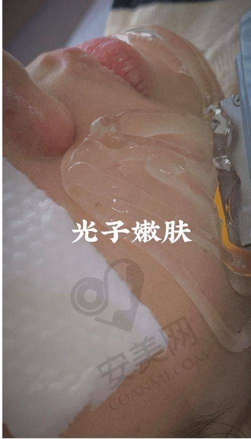 医生是如何诊断我的皮肤状况的？