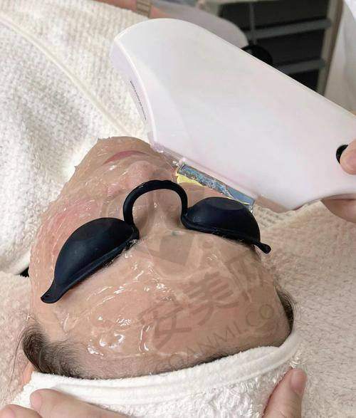 光子嫩肤适合所有人吗？