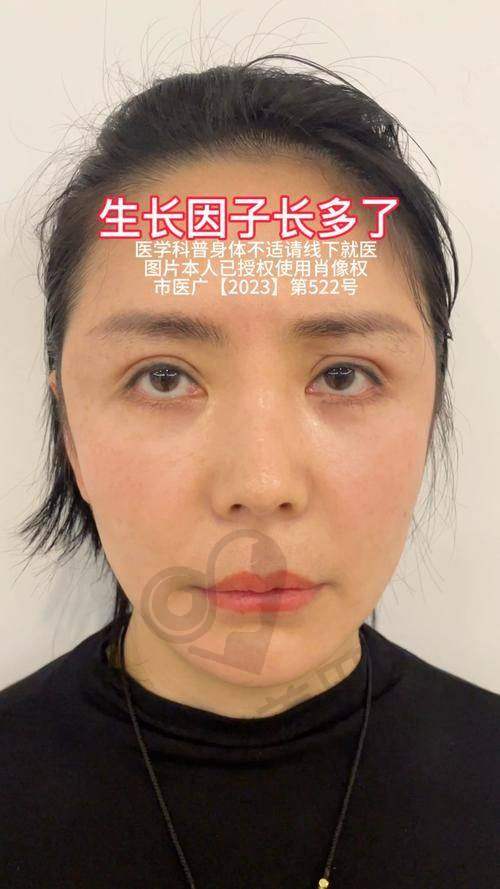 北京煤医生子因子修复与其他修复技术相比有何不同？