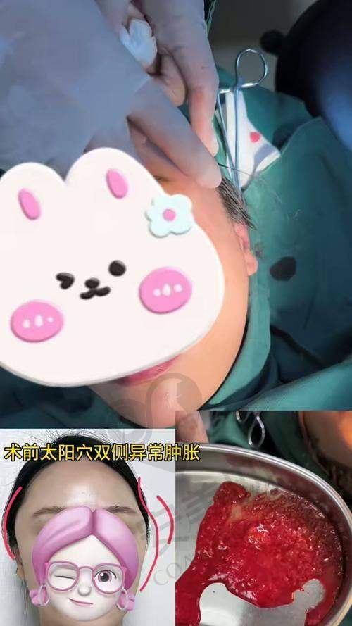 子因子修复项目是什么？