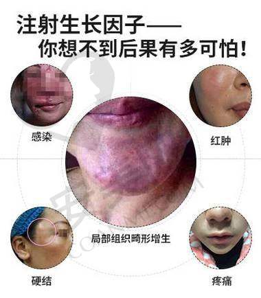 子因子修复项目适合哪些人群？