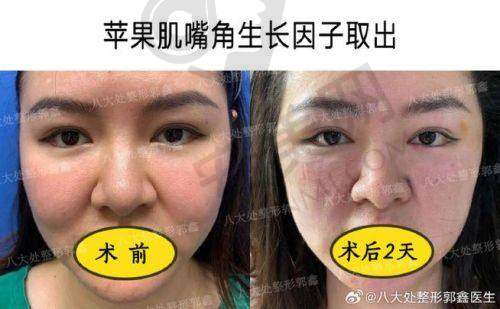 北京煤医生子因子修复的安心性如何保护？
