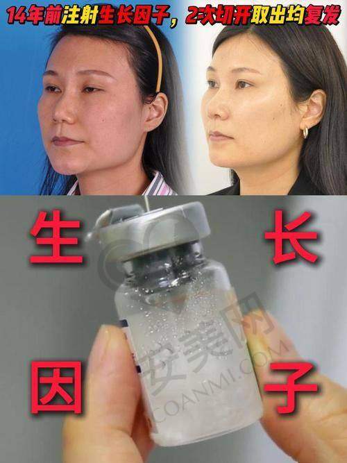 北京煤医生子因子修复在肌肤抗衰方面成效如何？