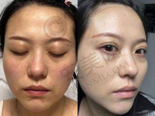 北京美莱的医生团队怎么样？