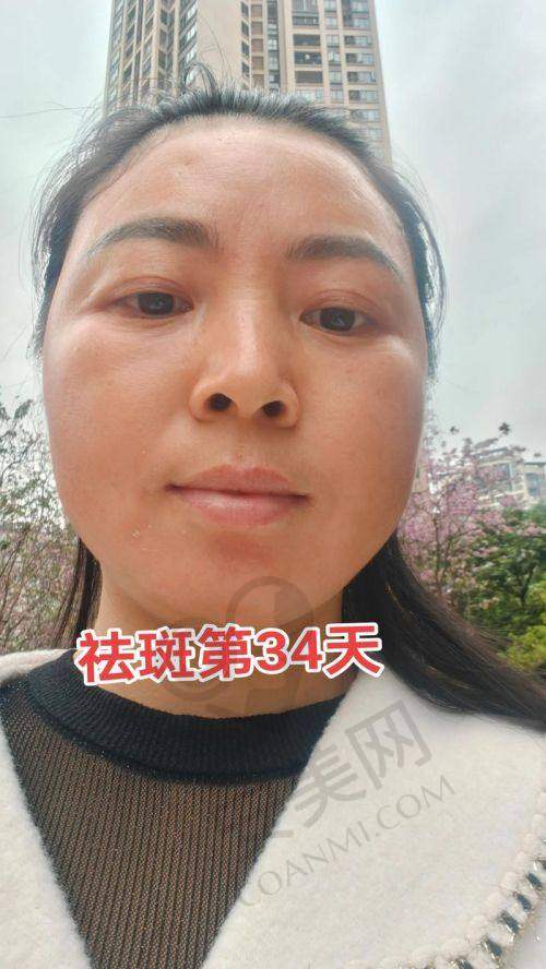 总结