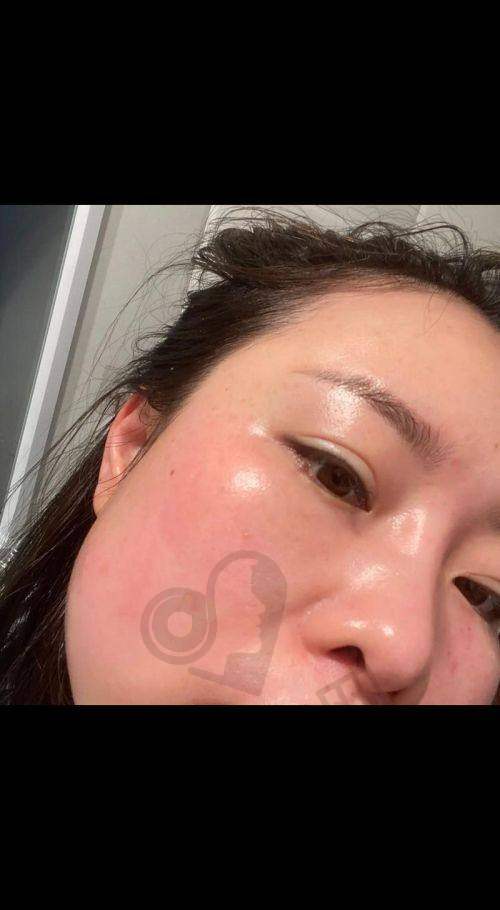 总结