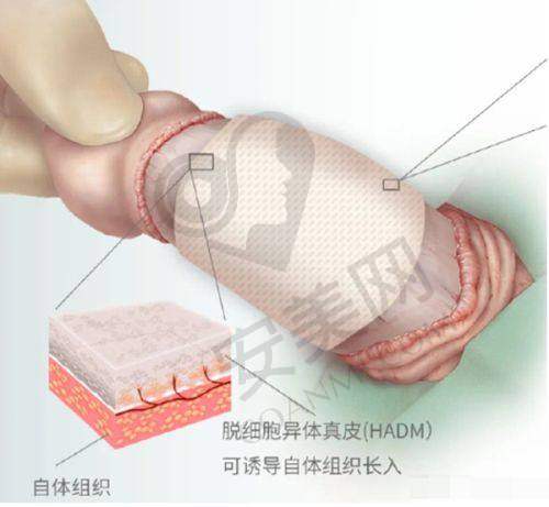 持久成效：5 - 8年的青春守护