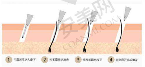 四、福州靓壹生医疗美容植发科地址电话：