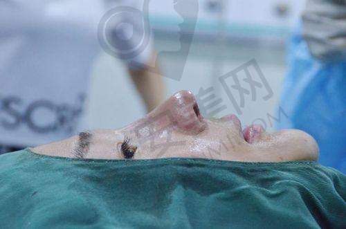 3、重庆东上毕胜医师整形技术怎么样？