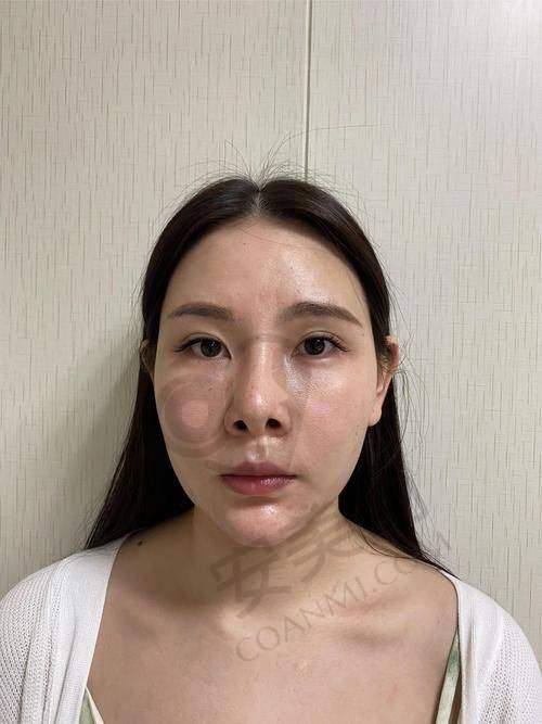 蒋思军——广州曙光医学美容医院