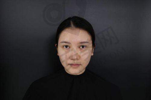李光琴——广州韩妃整形医院
