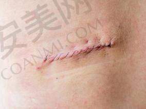 1、重庆东上杨东运医生怎么样？