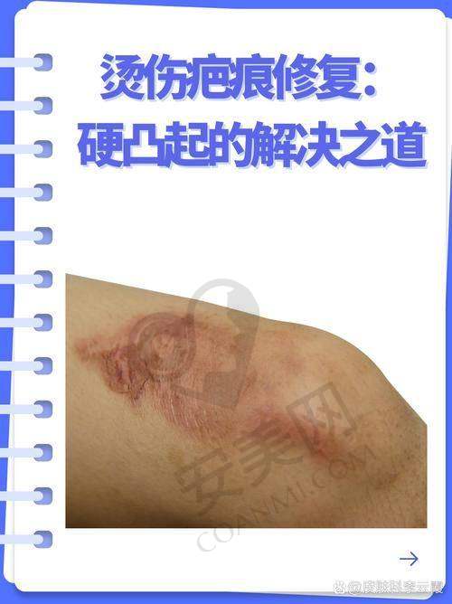 5、重庆东上杨东运医生患者评价
