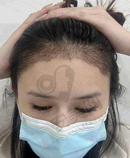 五、福州靓壹生医疗美容植发科预约挂号流程：