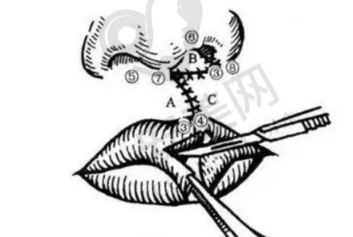 洛阳孔繁荣医院的医美技术怎么样？