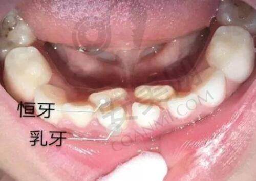3、北京星洲赵作均医生整形技术怎么样？