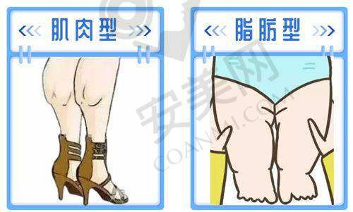 特色整形项目