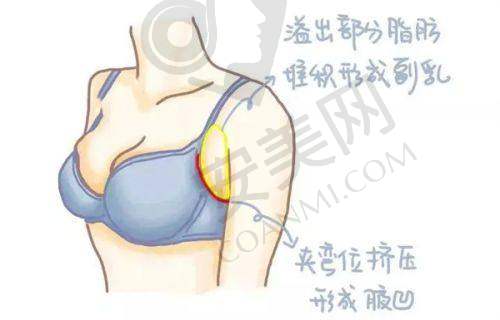 眼部整形项目价格分析
