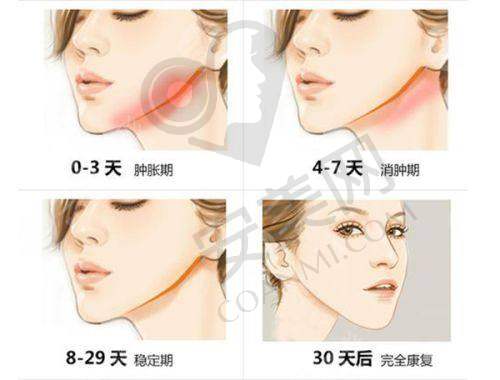 如何选择适合自己的医美整形项目？洛阳孔繁荣来帮忙