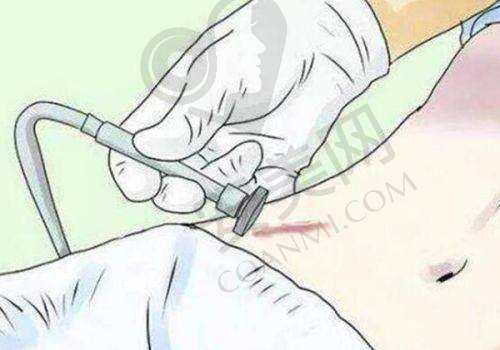 优势与保护