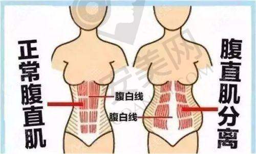 主要整形项目