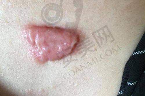 在上海江城皮肤医院就诊的感受如何？
